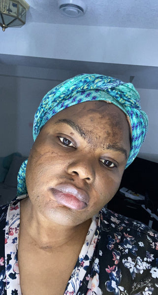 Whitening Black Soap Gel